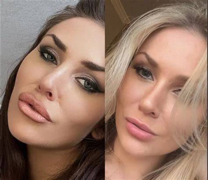 Are cleft chins rare?