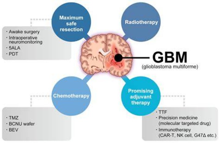 Are glioblastoma multiforme hereditary?