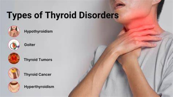Are thyroid problems common?