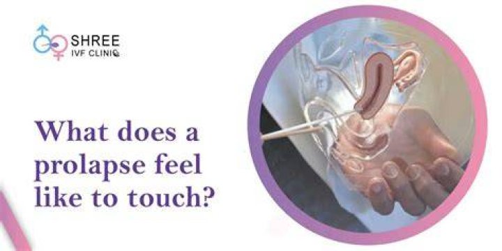 Can a prolapse make you feel ill?