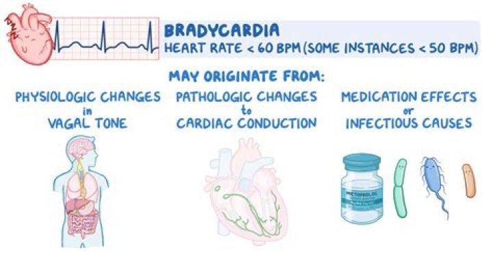 Can atenolol cause bradycardia?