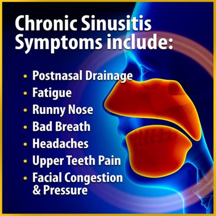 Can clogged sinuses cause dizziness?