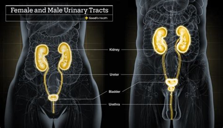 Can douching cause uti?