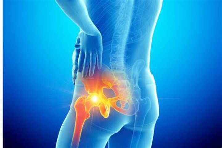 Can hip pain be gout?