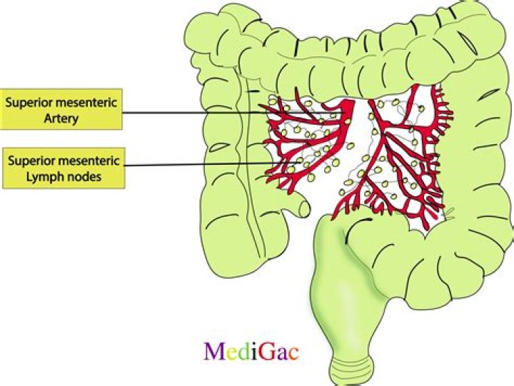 Can mesenteric adenitis lead to cancer?