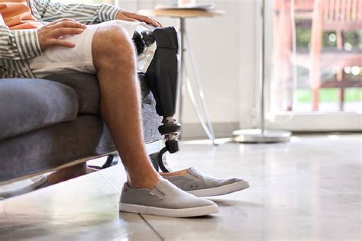 Can you buy prosthesis?