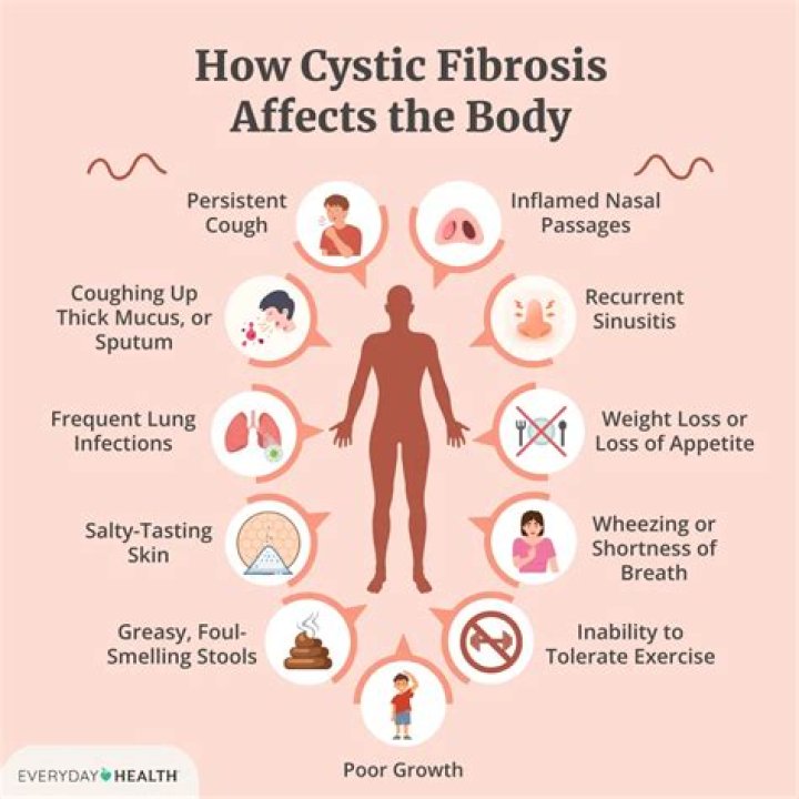 Did hazel grace have cystic fibrosis?