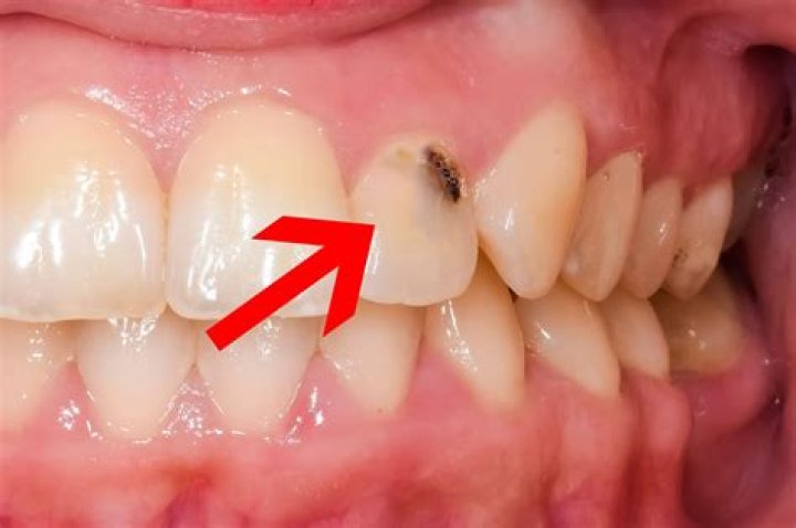 Do i have poliosis?