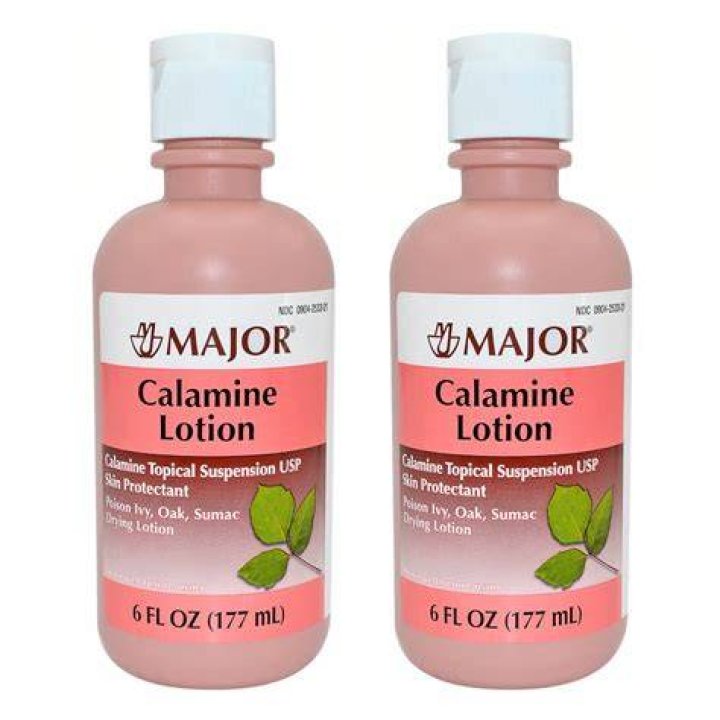 Do you rinse off calamine lotion?