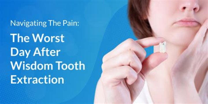 Does it hurt to irrigate wisdom teeth?
