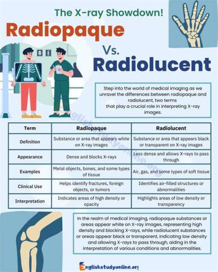 Does radiopaque penetrate or absorb?