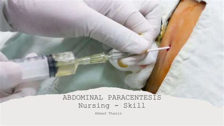 Is paracentesis a surgical procedure?