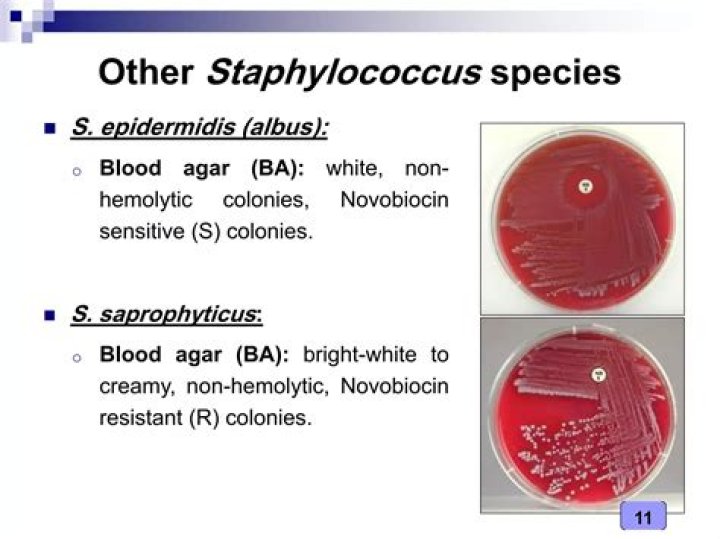 Is staph aureus pyr positive?