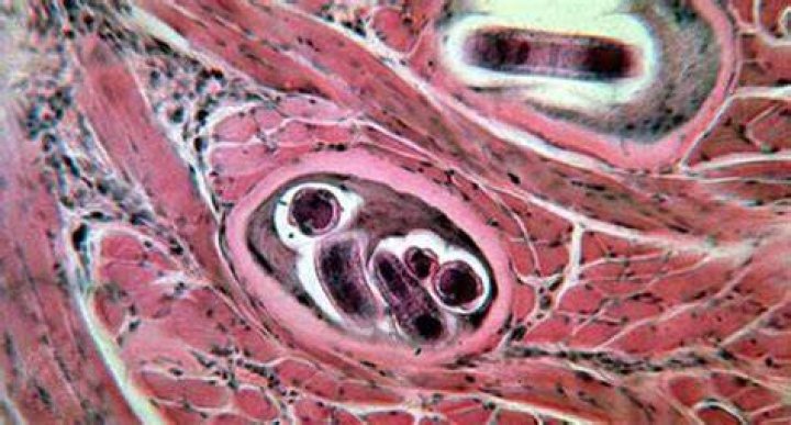 Is trichinosis still a problem with pork?
