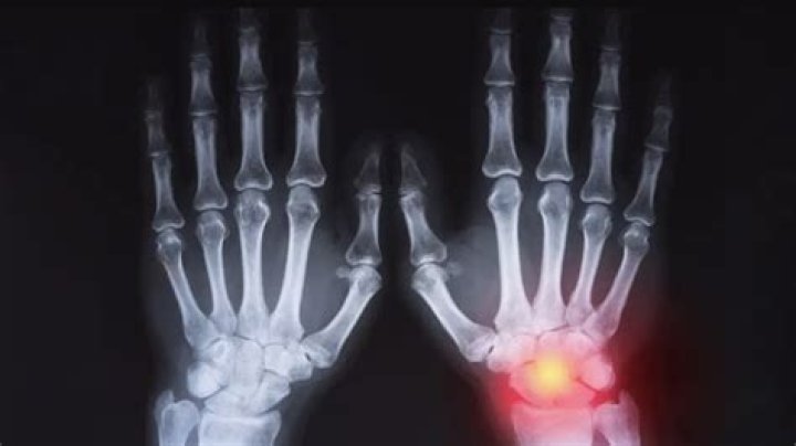 Is x ray harmful?