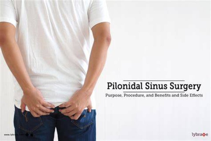 What is pilonidal sinus surgery?
