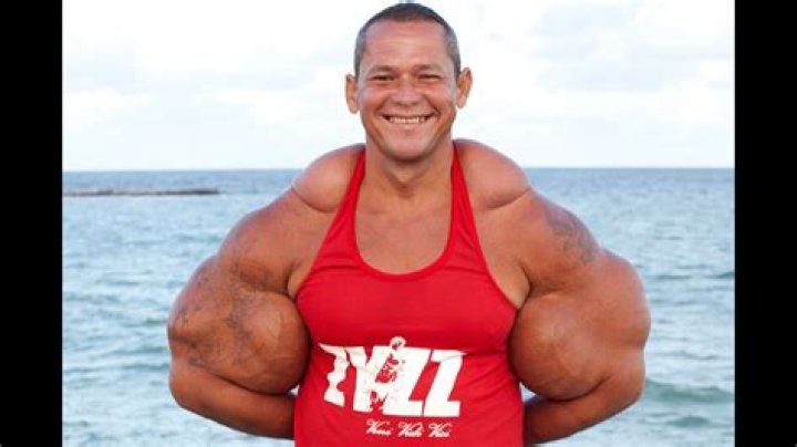 What is synthol injection?