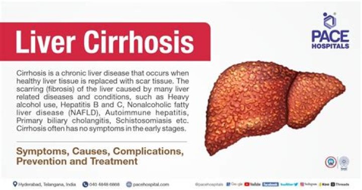 What is the most common cause of cirrhosis?