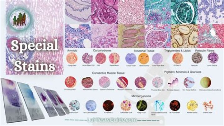 Whats a general tissue staining?