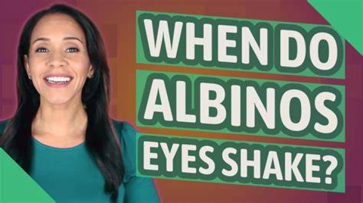 When do albinos eyes shake?