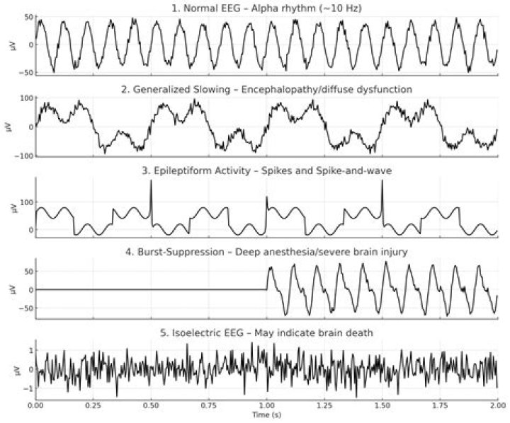 When does triphasic shift occur?