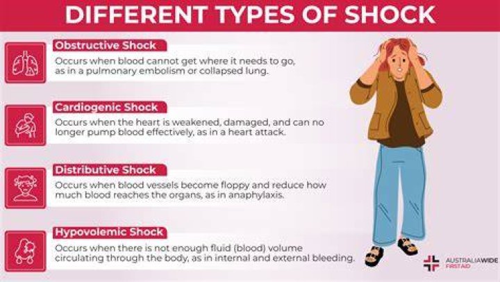 Where does psychogenic shock occur?