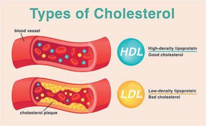 Where is cholesterol found in the body?