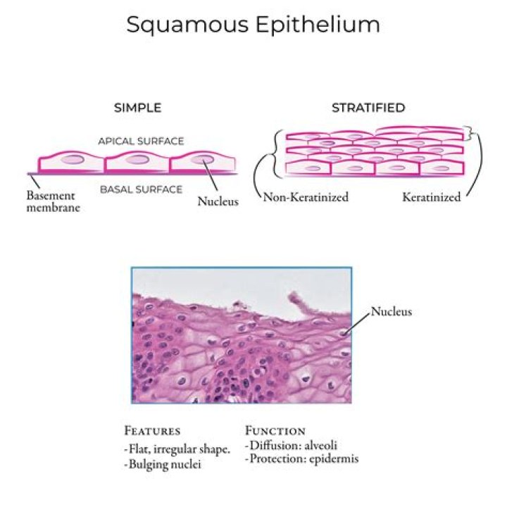 Where is stratified squamous epithelium found in the body?