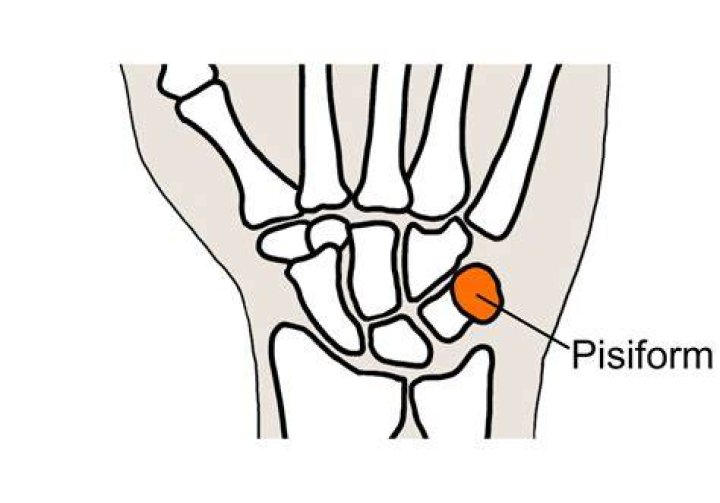 Why is my pisiform?