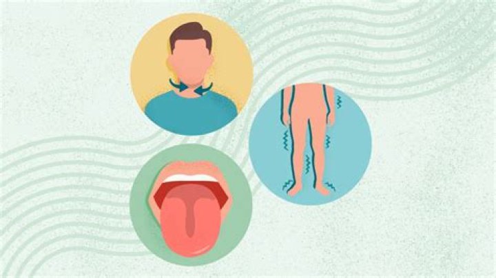 Will seroquel help tardive dyskinesia?